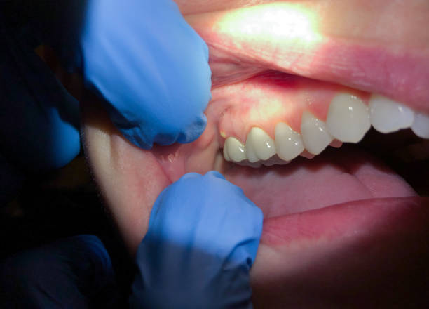 Best Emergency Cosmetic Dentistry in Dover Beaches South, NJ